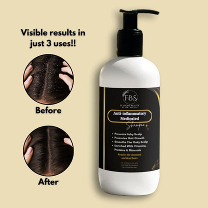 Anti-Inflammatory Medicated Shampoo🫧 | With Vitamins, Minerals & Proteins