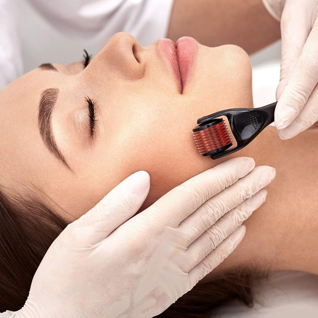 Derma Roller 2 in 1 | For Skin(Texture) & Hair(Growth)